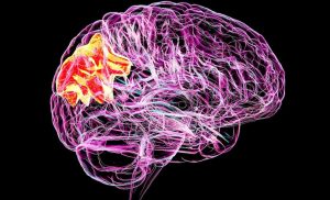 Scientists discover a way to erase bad memories