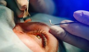 Read more about the article شیوع بالای قوز قرنیه در ایران و عوامل مؤثر بر نابینایی