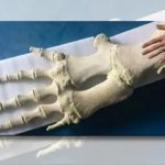 شباهت جالب استخوان باله نهنگ به انگشتان دست انسان